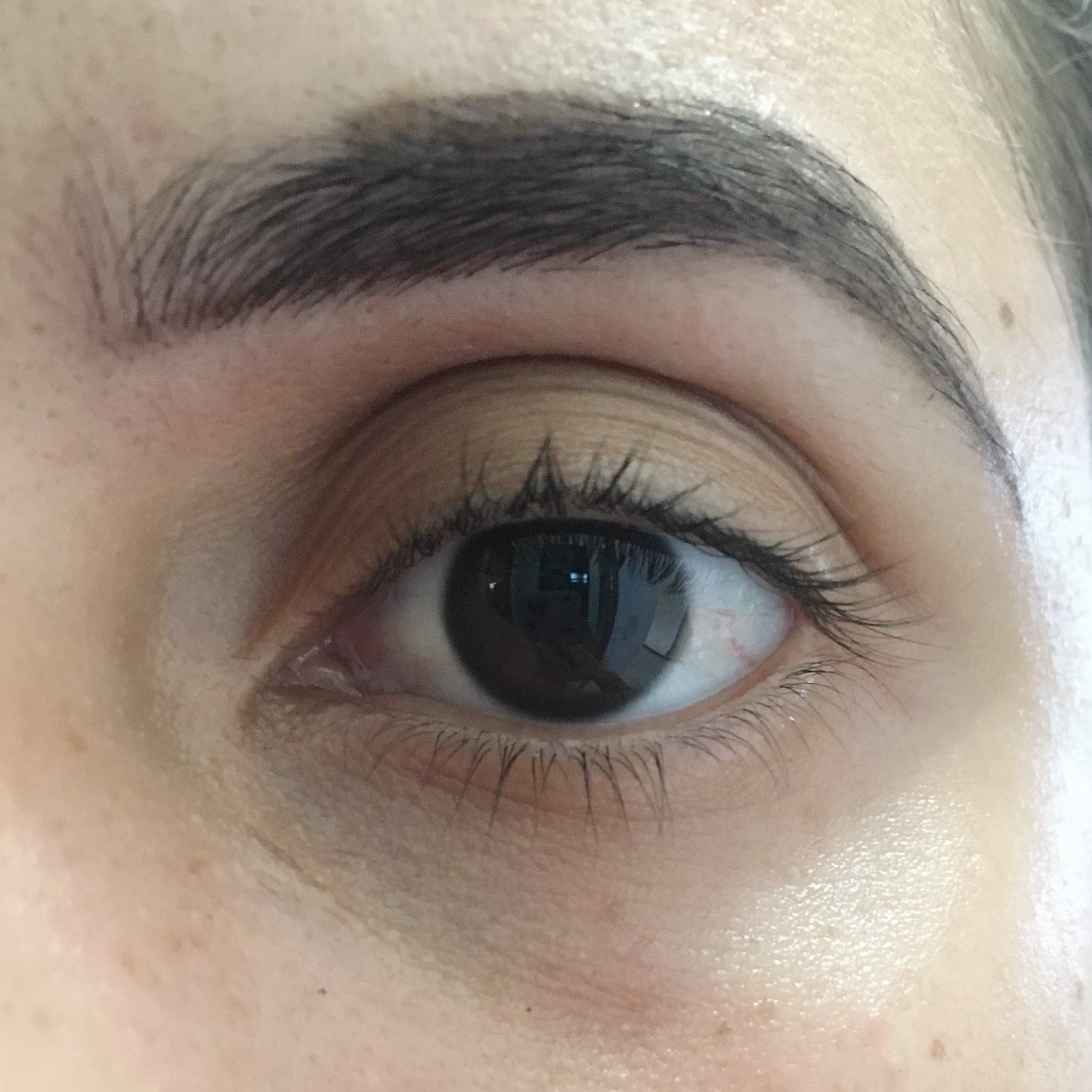 correcao de sobrancelhas