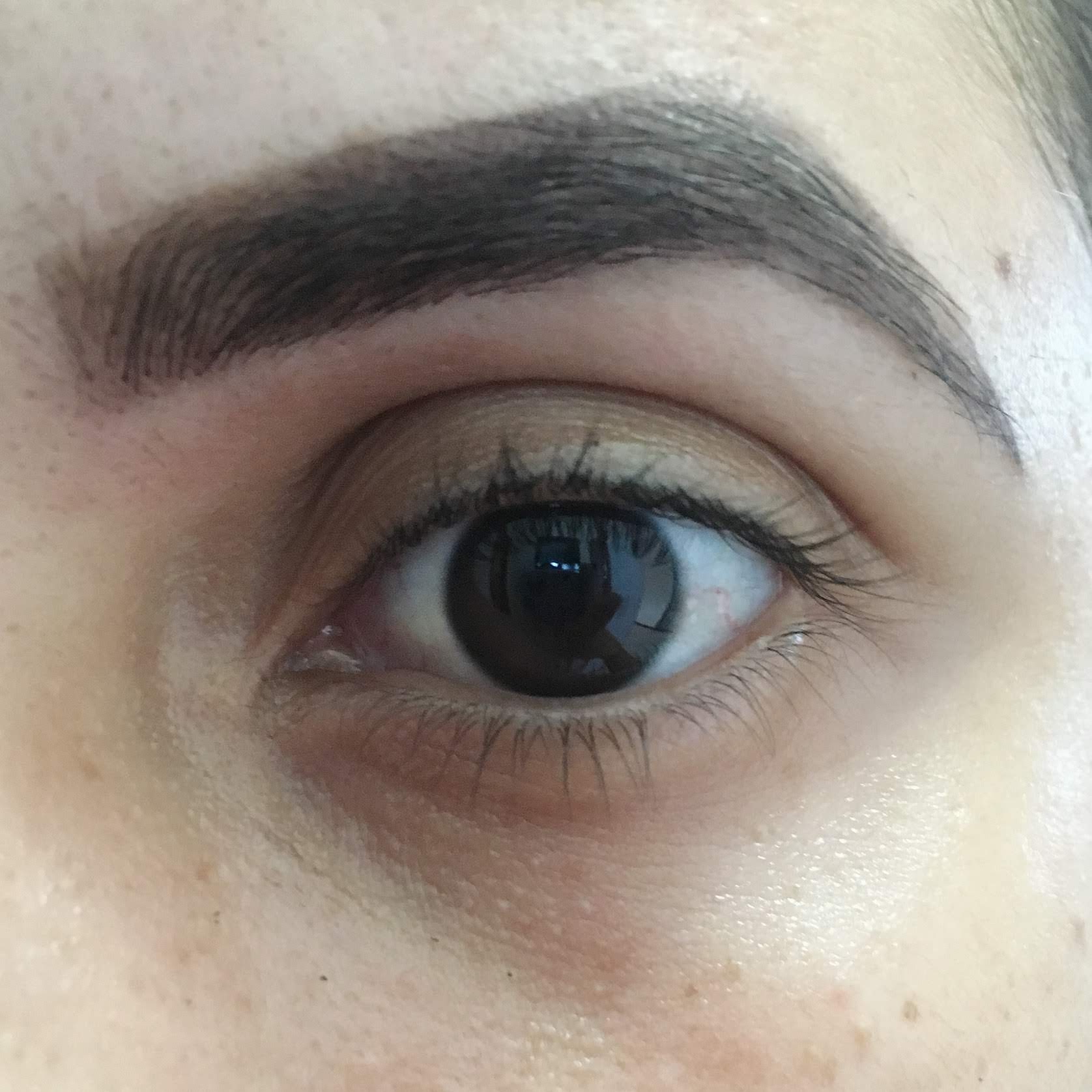 correcao de sobrancelhas