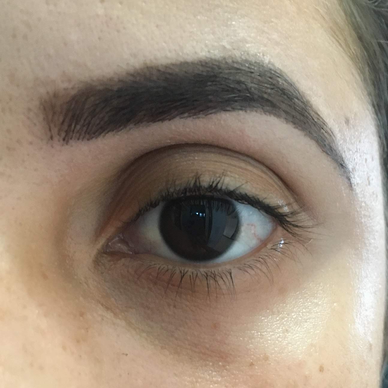 correcao de sobrancelhas